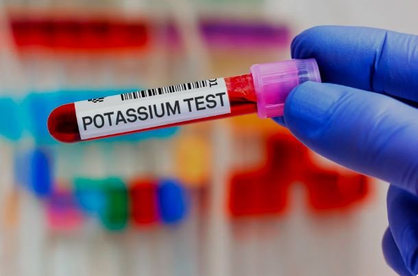 Sodium & Potassium Correction