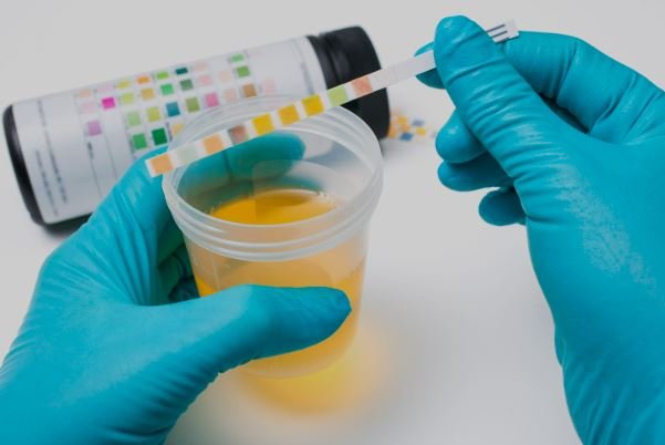 Urinary Tract Infection